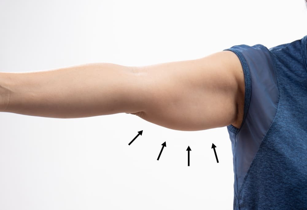 Tratamientos para flacidez